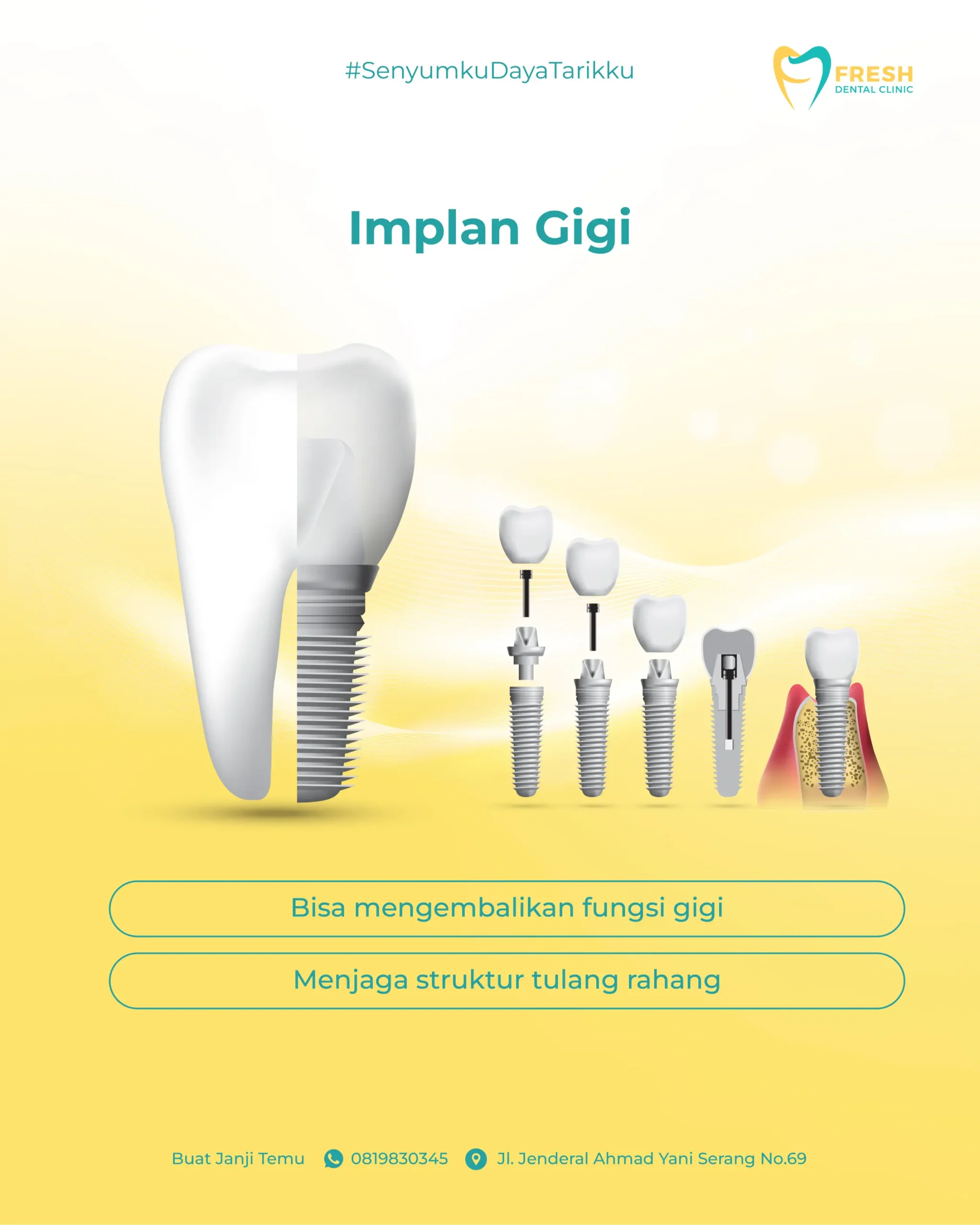 Fresh Dental_13 - Slide 2